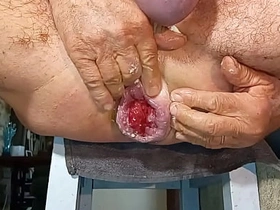 扩肛侠2025-14 asian village gay boys making love caught videos