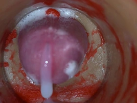 内射实录——体内镜头捕捉男性深喉射精 asian gay sexual congress videos gym