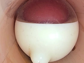 深穴摄像头记录避孕套内巨量精液喷射 new south asian detached sexual congress videos