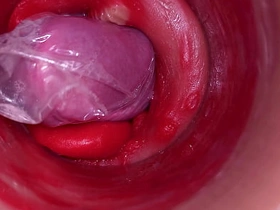 深入阴道的摄像头记录下带着套套的巨量射精 asian gay sourav singh sex videos